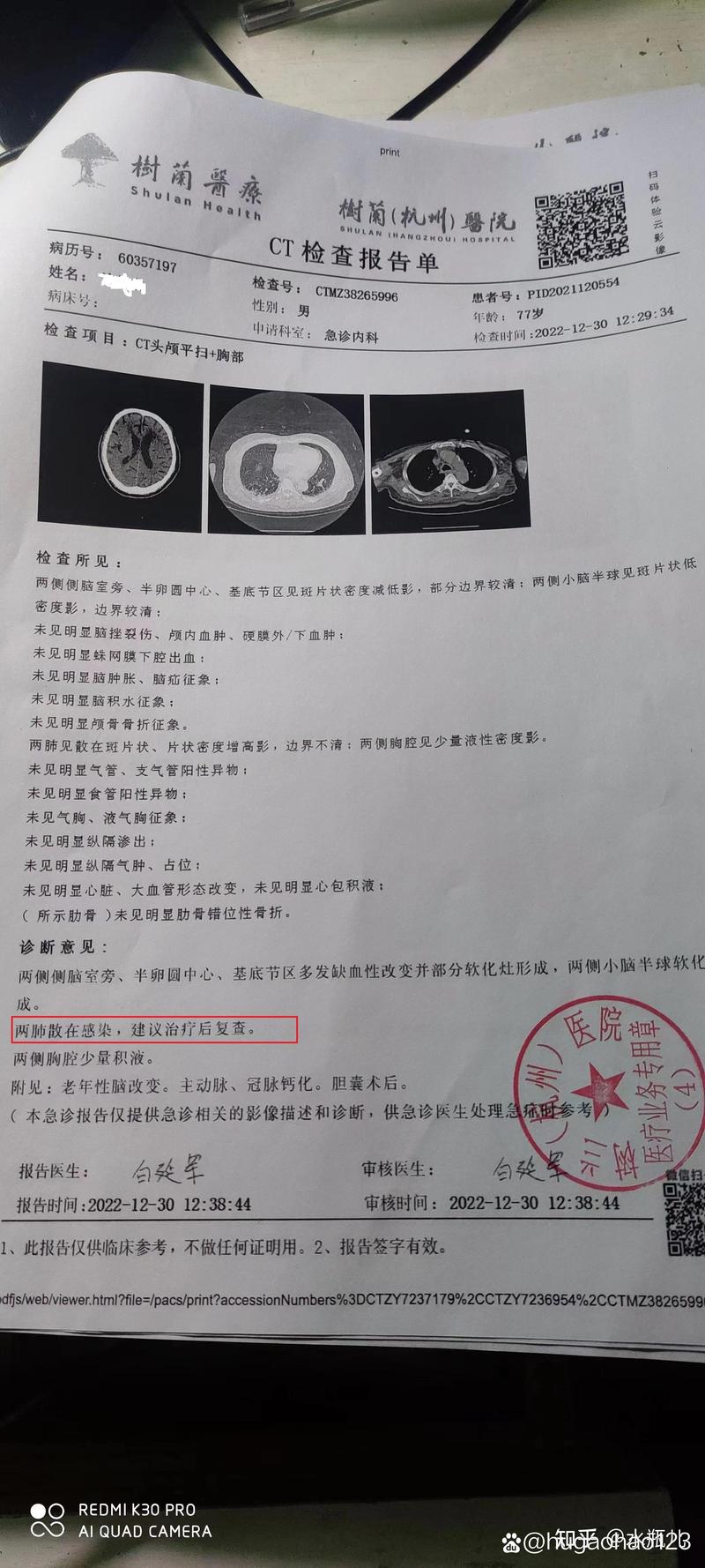 安化疫情确诊/安化最新疫情