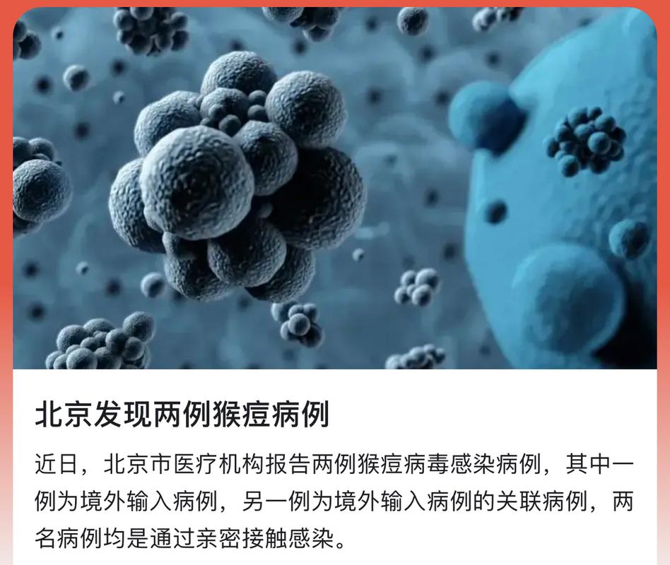 猴痘疫情(猴痘疫情全球最新消息)-第5张图片