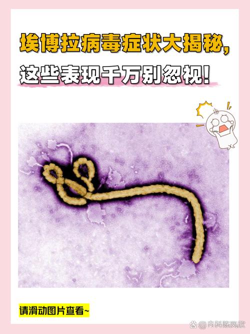 刚果埃博拉疫情,刚果埃博拉疫情为全球卫生紧急事件-第8张图片 刚果埃博拉疫情,刚果埃博拉疫情为全球卫生紧急事件-第8张图片